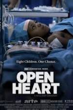 Watch Open Heart 9movies